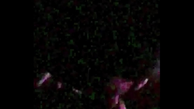 Annetta Xxx Doctor Medium Tits Head Porn Games Webcam Model Hot